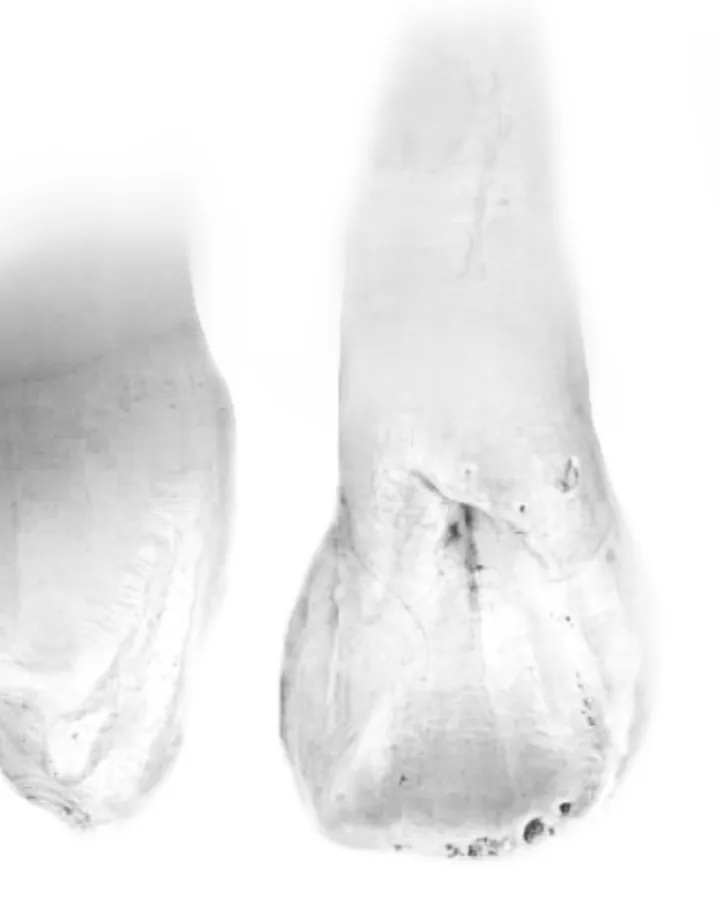 Sectioned natural teeth