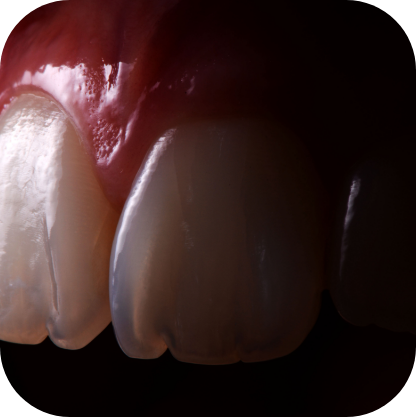 Magne Education biomimetic restorative dentistry Continuing Education photo detail course advanced composite veneers