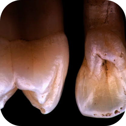 Magne Education biomimetic restorative dentistry Continuing Education photo detail course magne dinamico