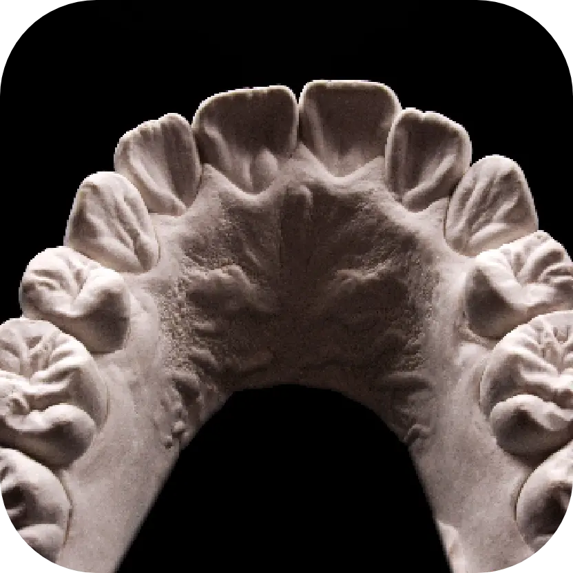 Magne Education biomimetic restorative dentistry Continuing Education photo detail course mastering morphology and esthetics