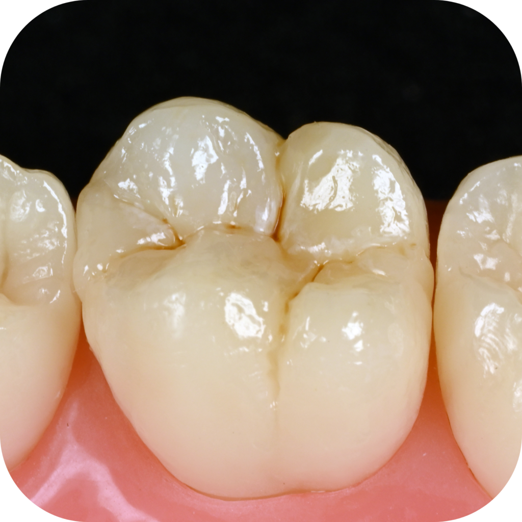 Magne Education biomimetic restorative dentistry Continuing Education photo detail course posterior 
