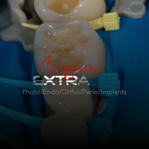 Magne Education biomimetic restorative dentistry Continuing Education course visuel extrawear V2