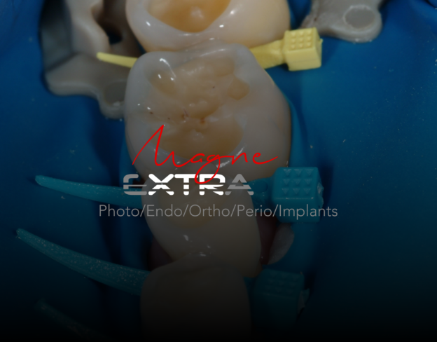 Magne Education biomimetic restorative dentistry Continuing Education course visuel extrawear V2