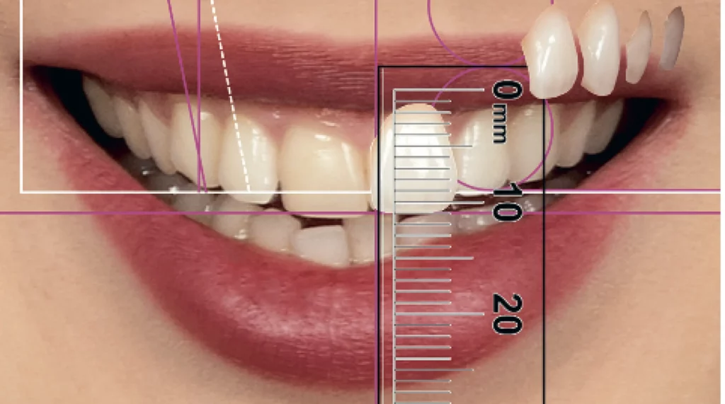 Magne Education dental photography course 2 mouth ruler scaled