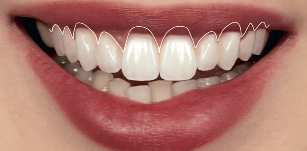 Magne Education dental photography course 2 photo3 scaled