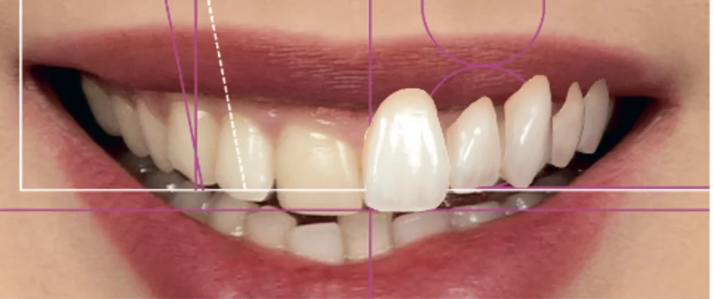 Magne Education dental photography course 2 teeth scaled