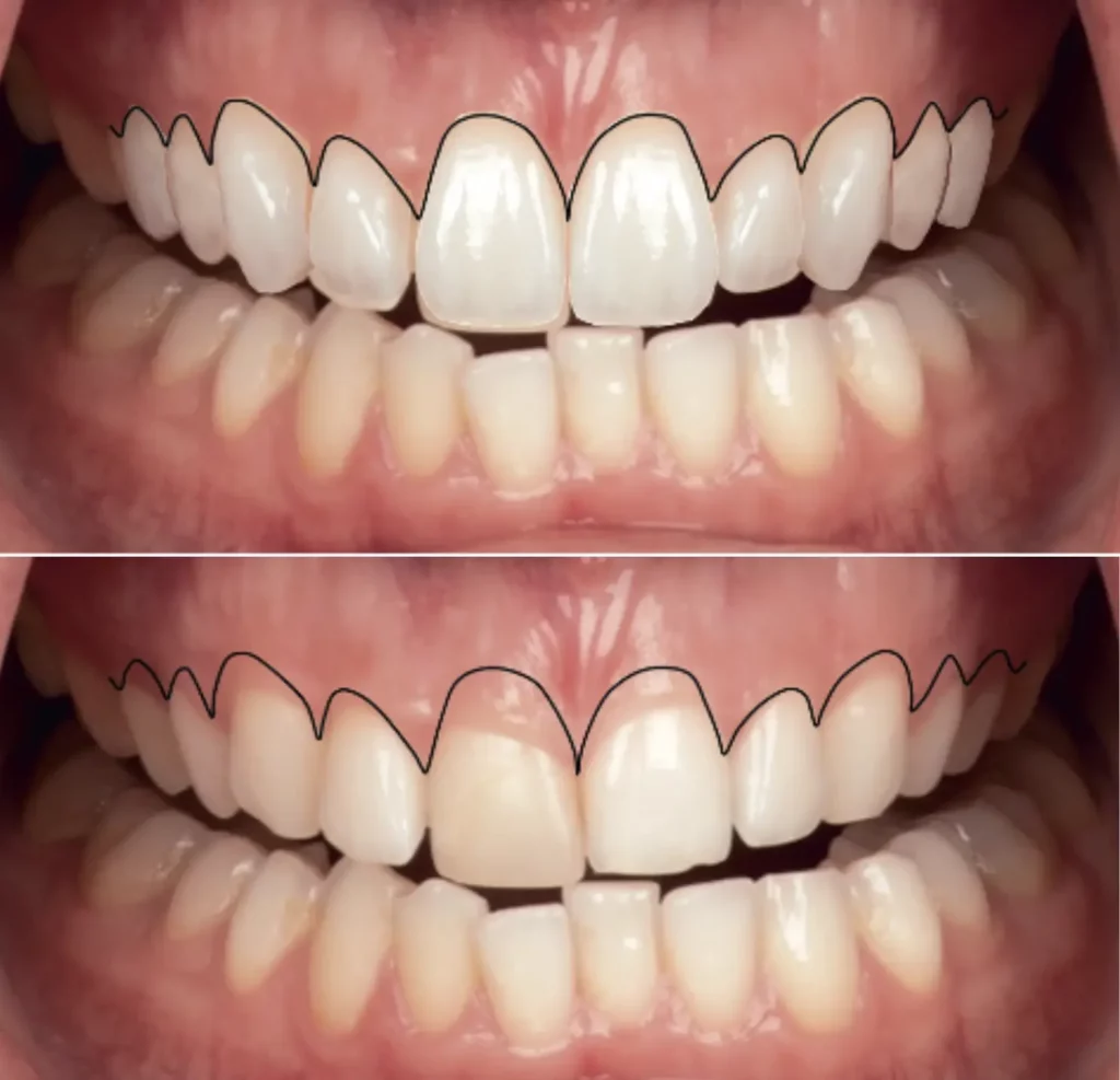 Magne Education dental photography course Over Under