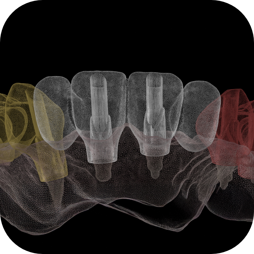 Magne Education dental Continuing Education photo detail course immediacy in full arch the next level dr att and sam alawi