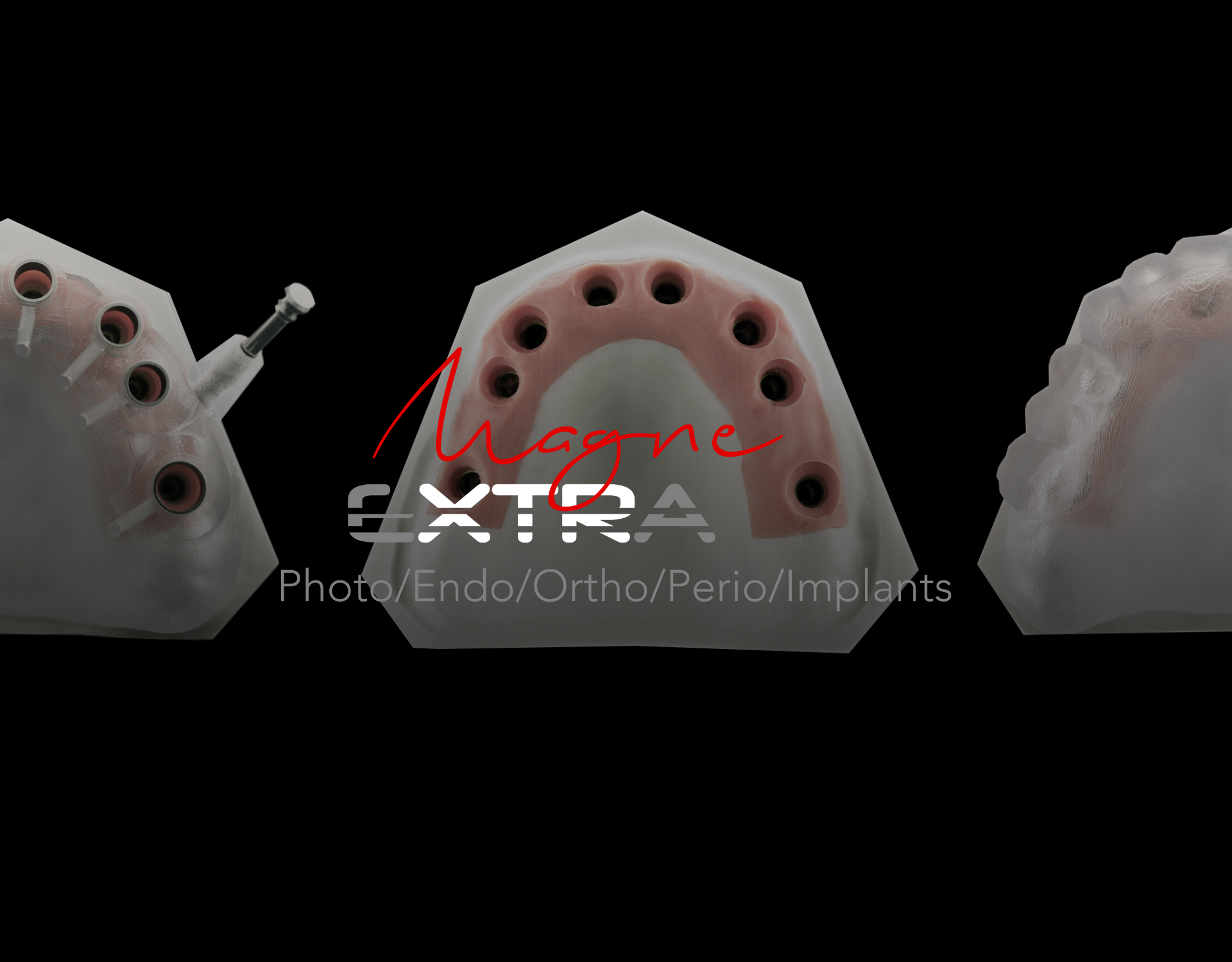 Chairside 3D Printing – Digital Implantology (January 9-10, 2026)