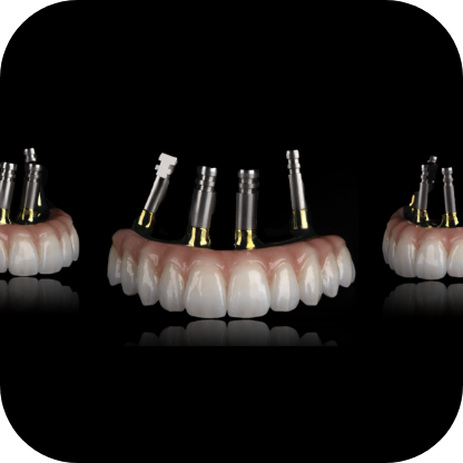 Magne Education dental Continuing Education photo detail immediacy in full arch the next level dr att and sam alawie