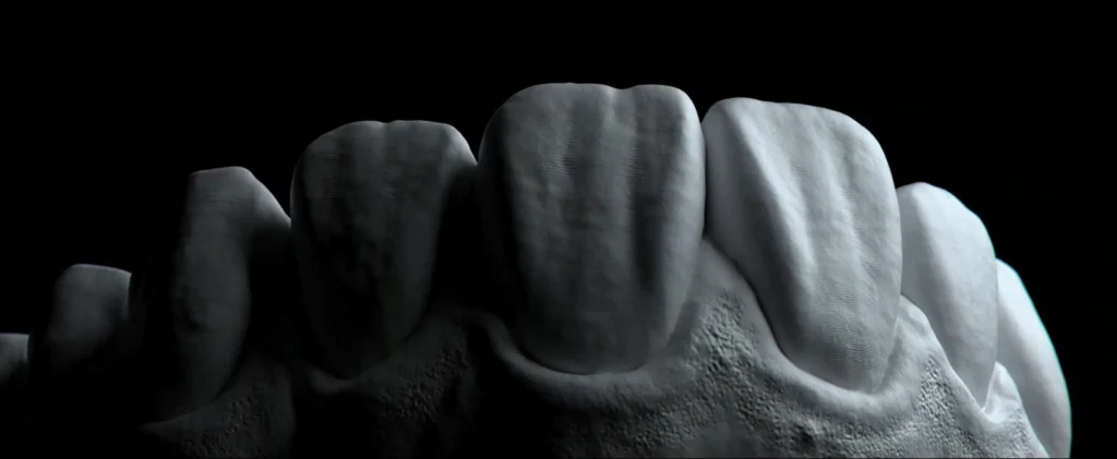 1 MASTERING MORPHOLOGY & ESTHETICS magne education beverly hills dental lab