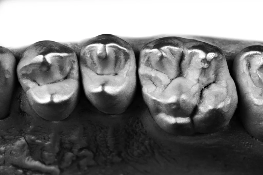2 POSTERIOR COMPOSITE RESTORATIONS magne education beverly hills dental lab
