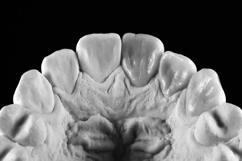 3 MASTERING MORPHOLOGY & ESTHETICS magne education beverly hills dental lab
