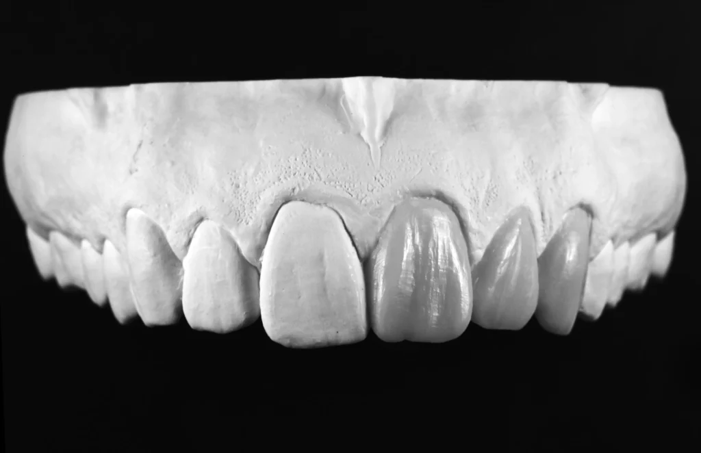 4 MASTERING MORPHOLOGY & ESTHETICS magne education beverly hills dental lab
