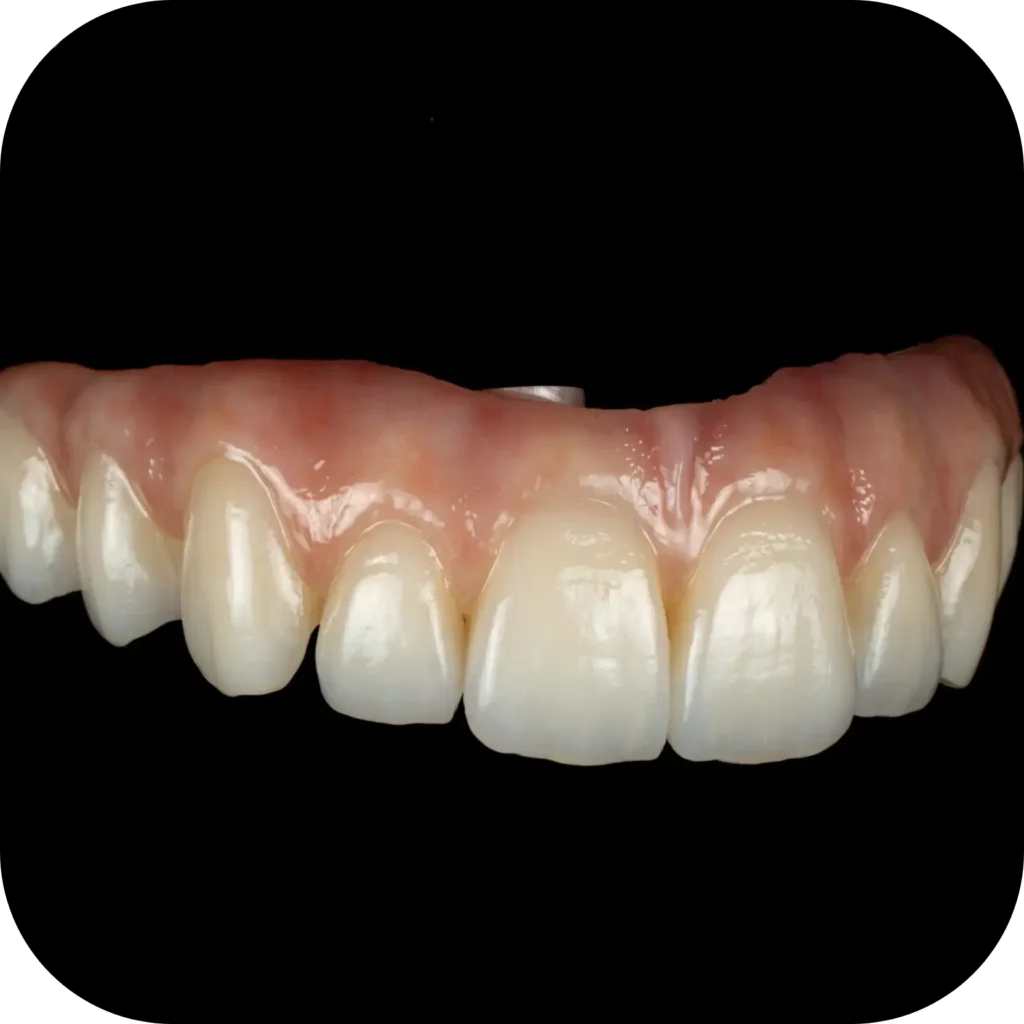 Magne Education biomimetic restorative dentistry Continuing Education developped picture